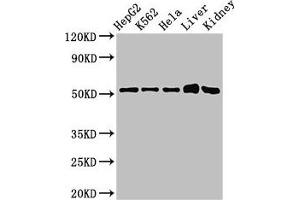 Western Blot Positive WB detected in: HepG2 whole cell lysate, K562 whole cell lysate, Hela whole cell lysate, Mouse liver tissue, Mouse kidney tissue All lanes: FBXW2 antibody at 3 μg/mL Secondary Goat polyclonal to rabbit IgG at 1/50000 dilution Predicted band size: 52, 45 kDa Observed band size: 52 kDa (FBXW2 抗体  (AA 72-340))