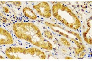 Immunohistochemistry of paraffin-embedded Human kidney using MT1-MMP Polyclonal Antibody at dilution of 1:100 (40x lens). (MMP14 抗体)