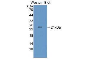 Western blot analysis of the recombinant protein. (LAMB2 抗体  (AA 939-1129))