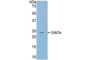 Western Blotting (WB) image for anti-serpin Peptidase Inhibitor, Clade A (Alpha-1 Antiproteinase, Antitrypsin), Member 6 (SERPINA6) (AA 57-256) antibody (ABIN7438406)