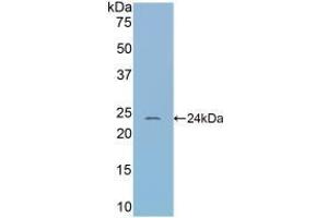 Detection of Recombinant CBG, Mouse using Polyclonal Antibody to Corticosteroid Binding Globulin (CBG) (SERPINA6 抗体  (AA 57-256))