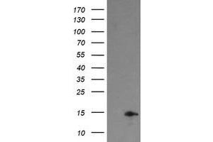 Image no. 1 for anti-Tumor Protein D52-Like 3 (TPD52L3) antibody (ABIN1501478) (TPD52L3 抗体)