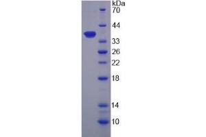 SDS-PAGE analysis of Human CAPN9 Protein. (Calpain 9 Protein (CAPN9))