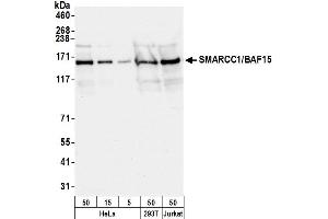 Western Blotting (WB) image for anti-SWI/SNF Related, Matrix Associated, Actin Dependent Regulator of Chromatin, Subfamily C, Member 1 (SMARCC1) (AA 750-800) antibody (ABIN7452049)