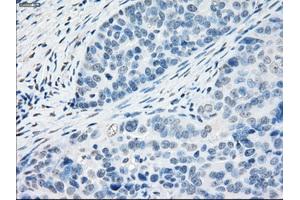 Immunohistochemical staining of paraffin-embedded Kidney tissue using anti-PPP5Cmouse monoclonal antibody. (PP5 抗体)