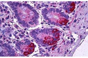 Human Intestine, Paneth Cells: Formalin-Fixed, Paraffin-Embedded (FFPE) (IL12A 抗体)