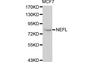 Western blot analysis of extracts of MCF-7 cells, using NEFL antibody. (NEFL 抗体)