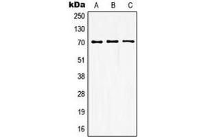 Western blot analysis of GUCY1B3 expression in HEK293T (A), mouse kidney (B), rat kidney (C) whole cell lysates.