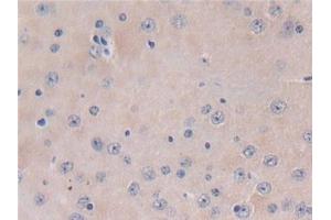Detection of TXNIP in Mouse Brain Tissue using Polyclonal Antibody to Thioredoxin-interacting Protein (TXNIP) (TXNIP 抗体  (AA 30-381))