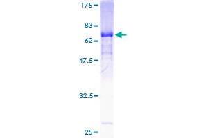 GDA Protein (AA 1-454) (GST tag)