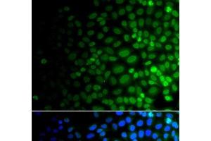 Immunofluorescence analysis of A549 cells using ULK4 Polyclonal Antibody (ULK4 抗体)