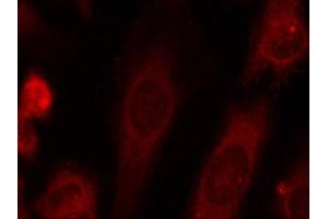 Immunofluorescence staining of methanol-fixed Hela cells using Phospho-EIF2S1-S51 antibody.
