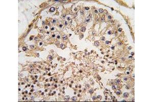 Immunohistochemistry (IHC) image for anti-B-Cell CLL/lymphoma 2 (BCL2) (AA 75-110) antibody (ABIN3030102)