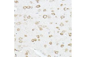 Immunohistochemistry (IHC) image for anti-Stearoyl-CoA Desaturase (Delta-9-Desaturase) (SCD) (C-Term) antibody (ABIN7270589)