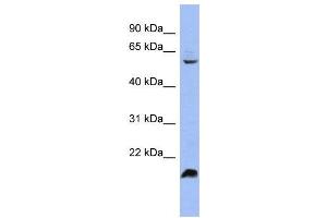 WB Suggested Anti-SFRS4 Antibody Titration:  0. (SRSF4 抗体  (Middle Region))