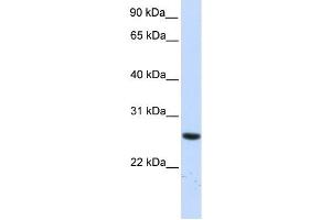TTC33 antibody used at 1 ug/ml to detect target protein. (TTC33 抗体  (N-Term))