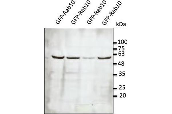 RAB10 抗体  (C-Term)