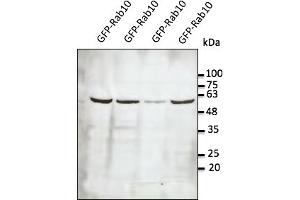 Western Blotting (WB) image for anti-RAB10, Member RAS Oncogene Family (RAB10) (C-Term) antibody (ABIN6254238) (RAB10 抗体  (C-Term))