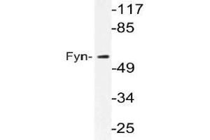 Western blot (WB) analysis of Fyn antibody in extracts from MCF-7 cells. (FYN 抗体)