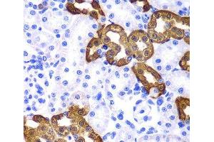 Immunohistochemistry of paraffin-embedded Rat kidney using KRT19 Polyclonal Antibody at dilution of 1:100 (40x lens). (Cytokeratin 19 抗体)