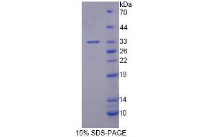 SDS-PAGE analysis of Human BRD2 Protein. (BRD2 蛋白)