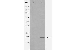 Western blot analysis of extracts of 293, using REG3A antibody. (REG3A 抗体  (Internal Region))