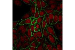 Confocal Immunofluorescence image of HeLa cells using Beta-Catenin Mouse Recombinant Monoclonal Ab (rCTNNB1/2173). (Recombinant CTNNB1 抗体)