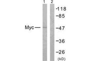 Western blot analysis of extracts from NIH-3T3 cells, treated with EGF 200ng/ml 30', using MYC (Ab-358) Antibody. (c-MYC 抗体  (AA 325-374))