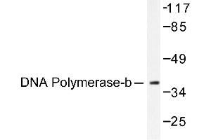 Image no. 1 for anti-Polymerase (DNA Directed), beta (POLB) antibody (ABIN265385) (POLB 抗体)