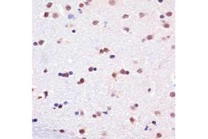 Immunohistochemistry (IHC) image for anti-TATA Box Binding Protein (TBP) antibody (ABIN3029100)