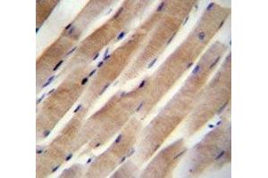 RHEB antibody immunohistochemistry analysis in formalin fixed and paraffin embedded human skeletal muscle.