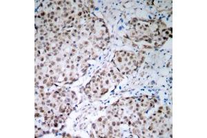 Immunohistochemistry (IHC) image for anti-Tumor Protein P53 (TP53) (pSer315) antibody (ABIN3020520) (p53 抗体  (pSer315))
