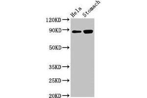Western Blot Positive WB detected in: Hela whole cell lysate, Rat stomach tissue All lanes: ASAH2 antibody at 3 μg/mL Secondary Goat polyclonal to rabbit IgG at 1/50000 dilution Predicted band size: 86, 82 kDa Observed band size: 86 kDa (ASAH2 抗体  (AA 255-506))