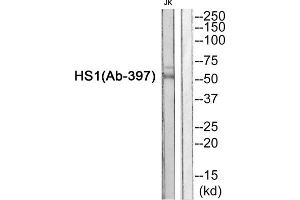 Western blot analysis of extracts from JurKat cells, using HS1 (epitope around residue 397) antibody. (HCLS1 抗体  (Tyr397))