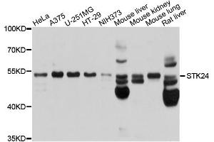 Western blot analysis of extracts of various cell lines, using STK24 antibody. (STK24 抗体)
