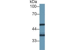 Western Blot; Sample: Human Hela cell lysate; Primary Ab: 1µg/ml Rabbit Anti-Mouse NAT1 Antibody Second Ab: 0. (NAT1 抗体  (AA 9-254))