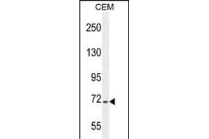 STIM1 Antibody (C-term) (ABIN654073 and ABIN2843969) western blot analysis in CEM cell line lysates (35 μg/lane). (STIM1 抗体  (C-Term))
