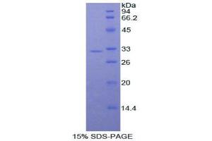 SDS-PAGE analysis of Dog ALCAM Protein. (CD166 蛋白)