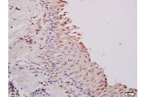 Formalin-fixed and paraffin embedded rat ovary tissue labeled with Anti A1BG Polyclonal Antibody,Unconjugated (ABIN872952) at 1:200 followed by conjugation to the secondary antibody and DAB staining. (A1BG 抗体  (AA 301-400))