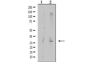 Western blot analysis of extracts from rat muscle, using TNFRSF10C  Antibody. (DcR1 抗体)