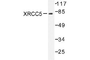 Image no. 1 for anti-X-Ray Repair Complementing Defective Repair in Chinese Hamster Cells 5 (Double-Strand-Break Rejoining) (XRCC5) antibody (ABIN271983) (XRCC5 抗体)