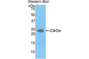 Western blot analysis of the recombinant protein. (GDF3 抗体  (AA 251-364))