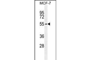 PCA Antibody (C-term) (ABIN655112 and ABIN2844743) western blot analysis in MCF-7 cell line lysates (35 μg/lane). (PMPCA 抗体  (C-Term))