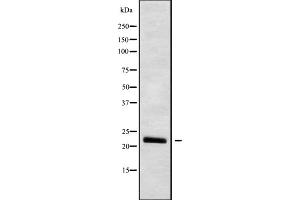Western blot analysis IFNW1 using HUVEC whole cell lysates (IFNW1 抗体  (C-Term))