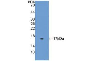 Western blot analysis of recombinant Mouse IL1F9. (IL1F9 抗体  (AA 5-149))