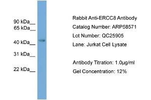 WB Suggested Anti-ERCC8  Antibody Titration: 0. (ERCC8 抗体  (Middle Region))