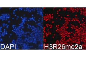 Immunofluorescence analysis of 293T cell using H3R26me2a antibody. (Histone 3 抗体  (H3R26me2))