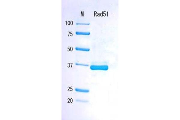 RAD51 蛋白