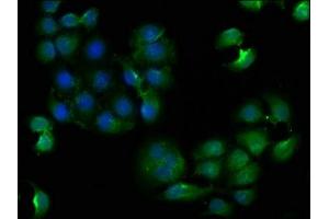 Immunofluorescence staining of A549 cells with ABIN7147850 at 1:133, counter-stained with DAPI. (CLTCL1 抗体  (AA 1423-1566))