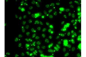 Immunofluorescence analysis of HeLa cells using SECISBP2 antibody (ABIN5974073). (SECISBP2 抗体)